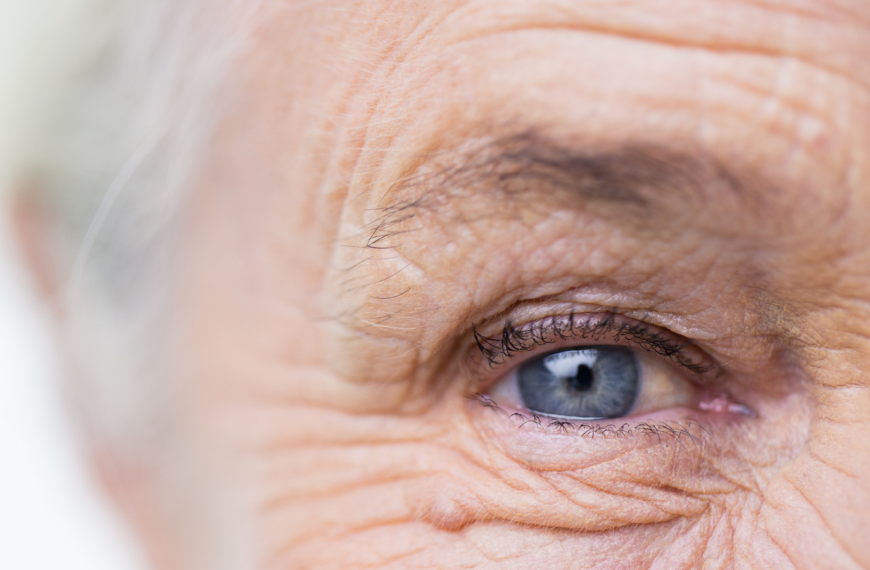 Una mirada al sobrepeso y la obesidad en la vejez