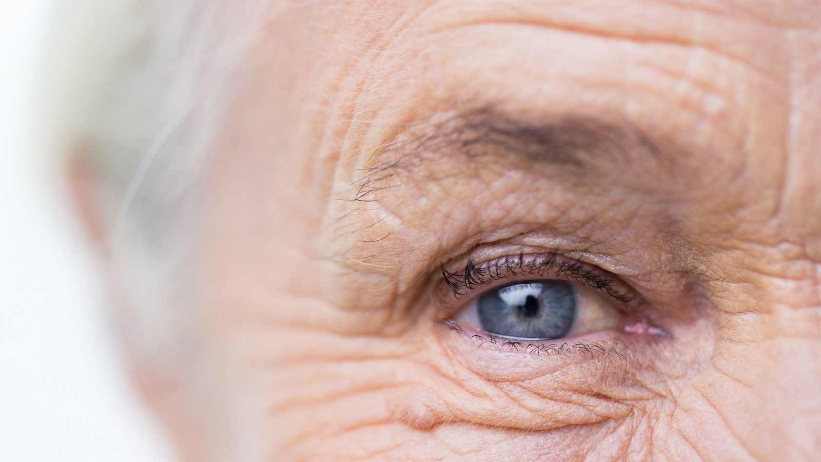 Una mirada al sobrepeso y la obesidad en la vejez